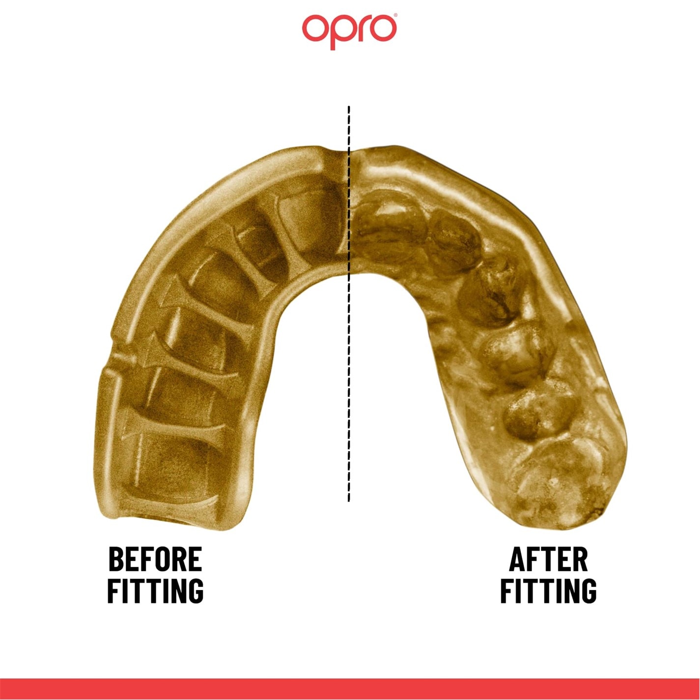 Opro Gold Self Fit 00