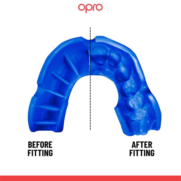 Opro Self Fit 00